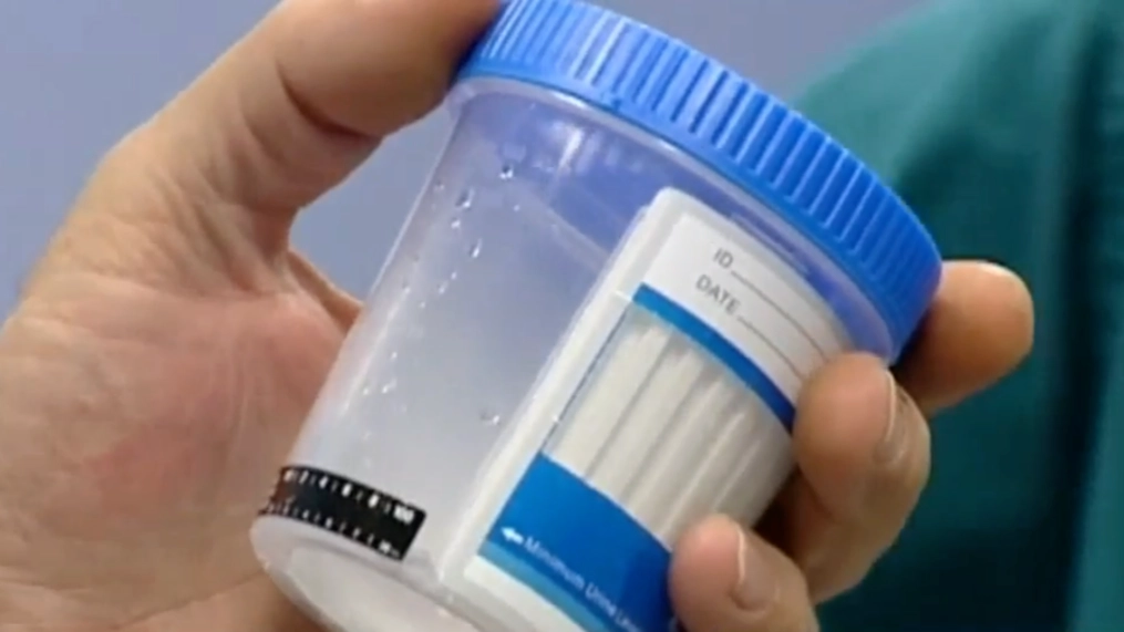 Drug Test Cups Can Enhance Your Travels